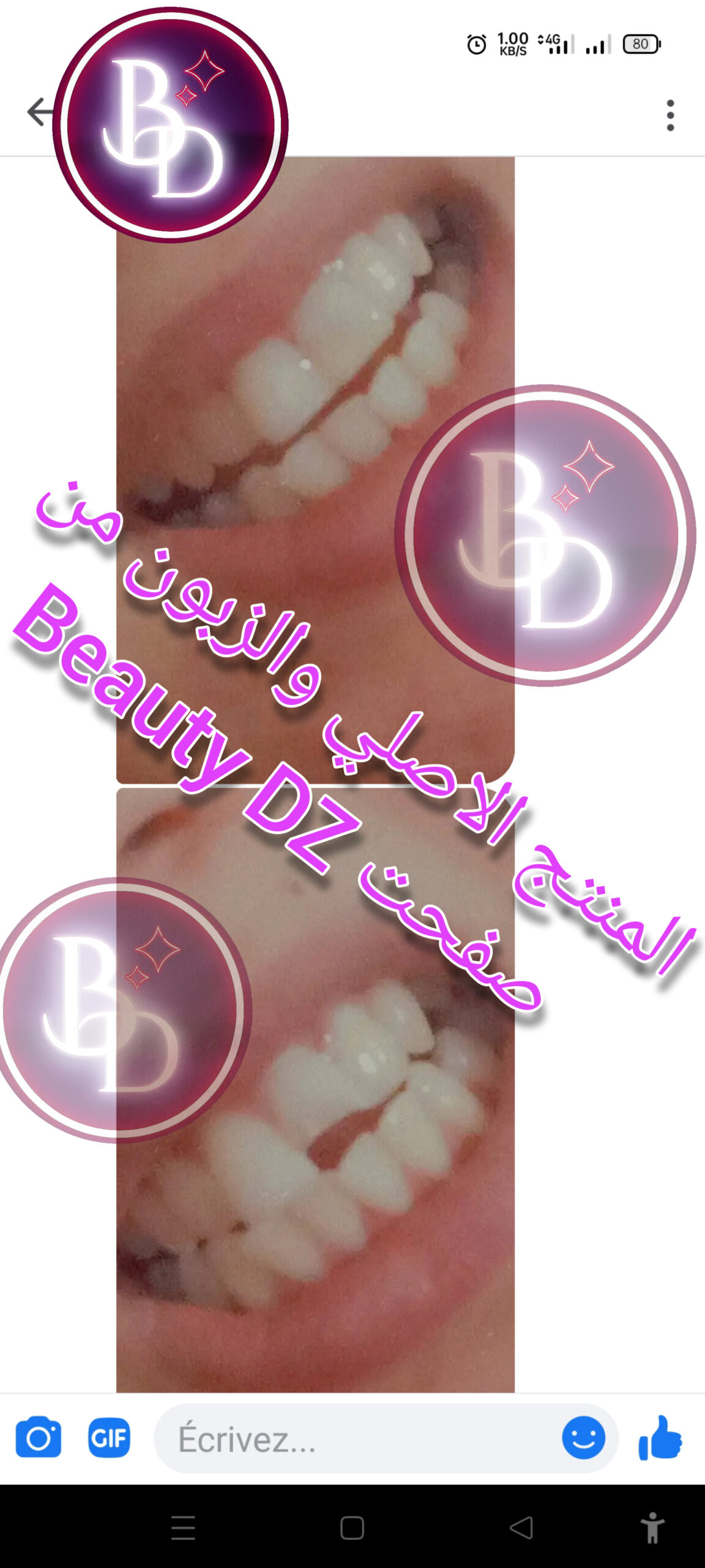 JMOldable Original - الصورة 5