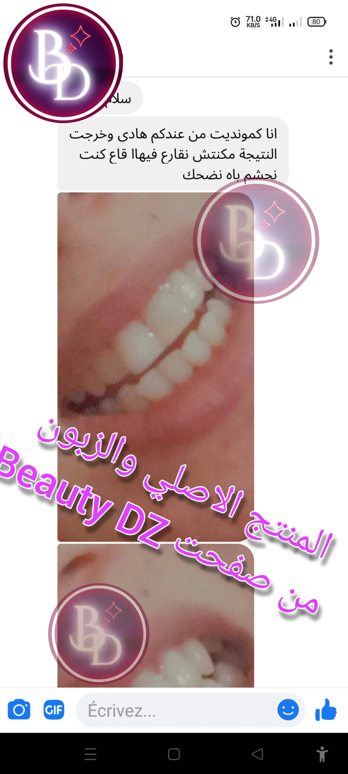 JMOldable Original - الصورة 4