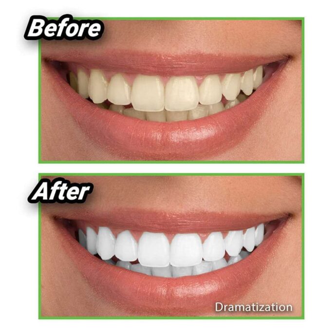 ⁦Miracle Teeth⁩ - الصورة ⁦2⁩