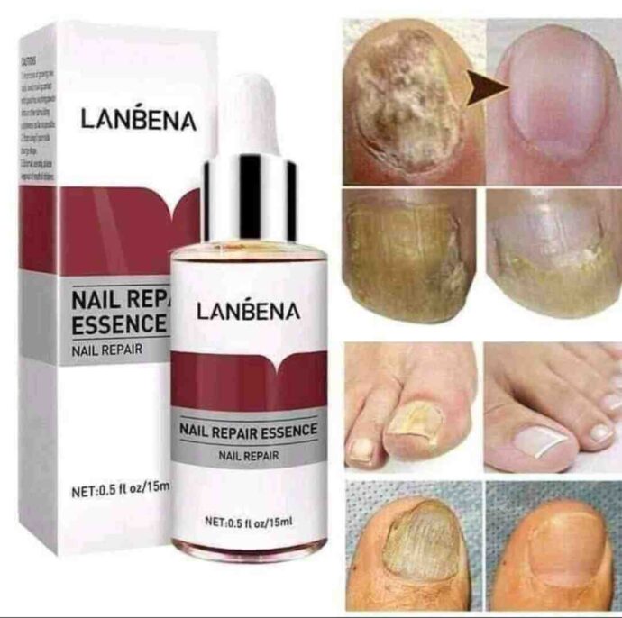 Lanbena Antifongique