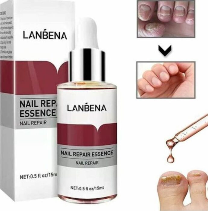 ⁦Lanbena Antifongique⁩ - الصورة ⁦2⁩