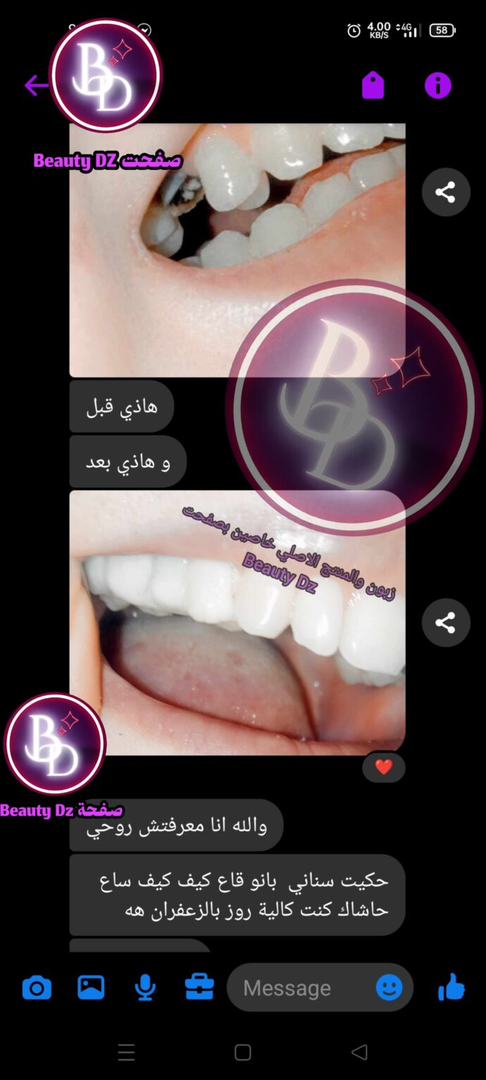 ⁦Moldable L⁩ - الصورة ⁦4⁩